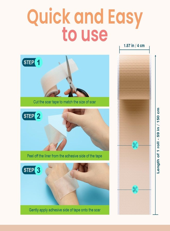 Adamson Premium Silicone Scar Tape for Surgical Marks - Reusable & Professional Silicone Scar Sheets - Medical Tape for Keloid, C-Section, Burns & More - All Skin Types (1.6"x 60" Roll-1.5M) - Image 4